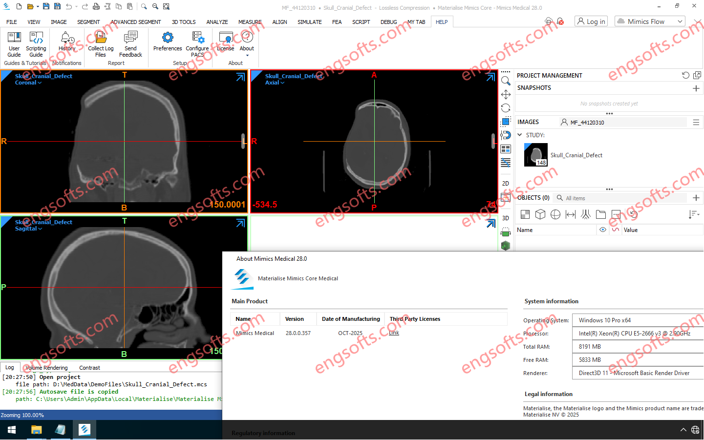 Materialise Mimics Core (Medical) 2026 v28.0-Engsofts
